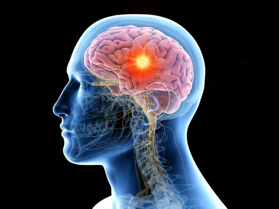 graphic of brain inside head
