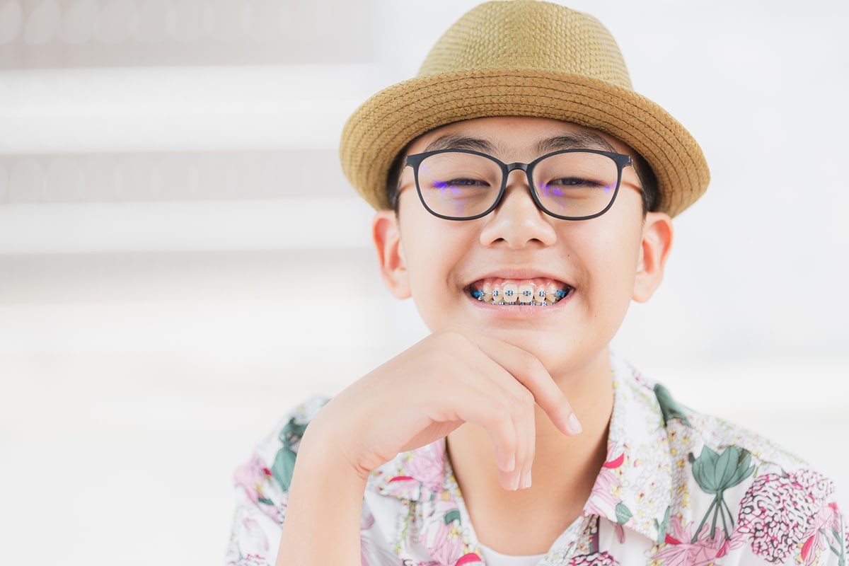 How Long Do Braces Take to Straighten Teeth? Grapevine, TX